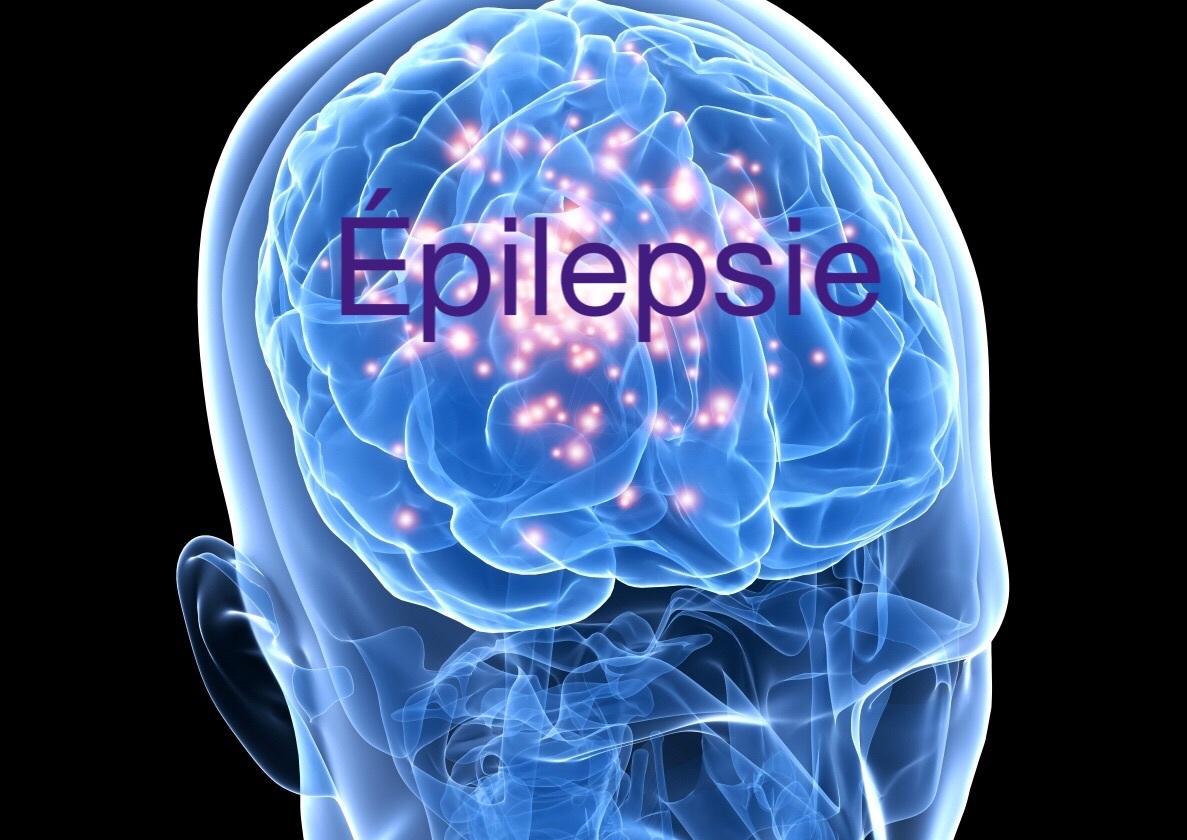 epilepsie-head_image